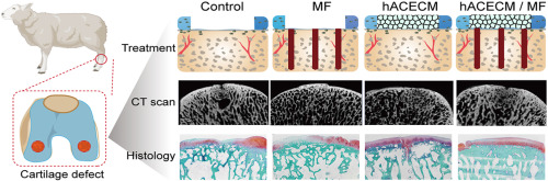 Combination of a human articular cartilage-derived extracellular matrix scaffold and microfracture techniques for cartilage regeneration: A proof of concept in a sheep model