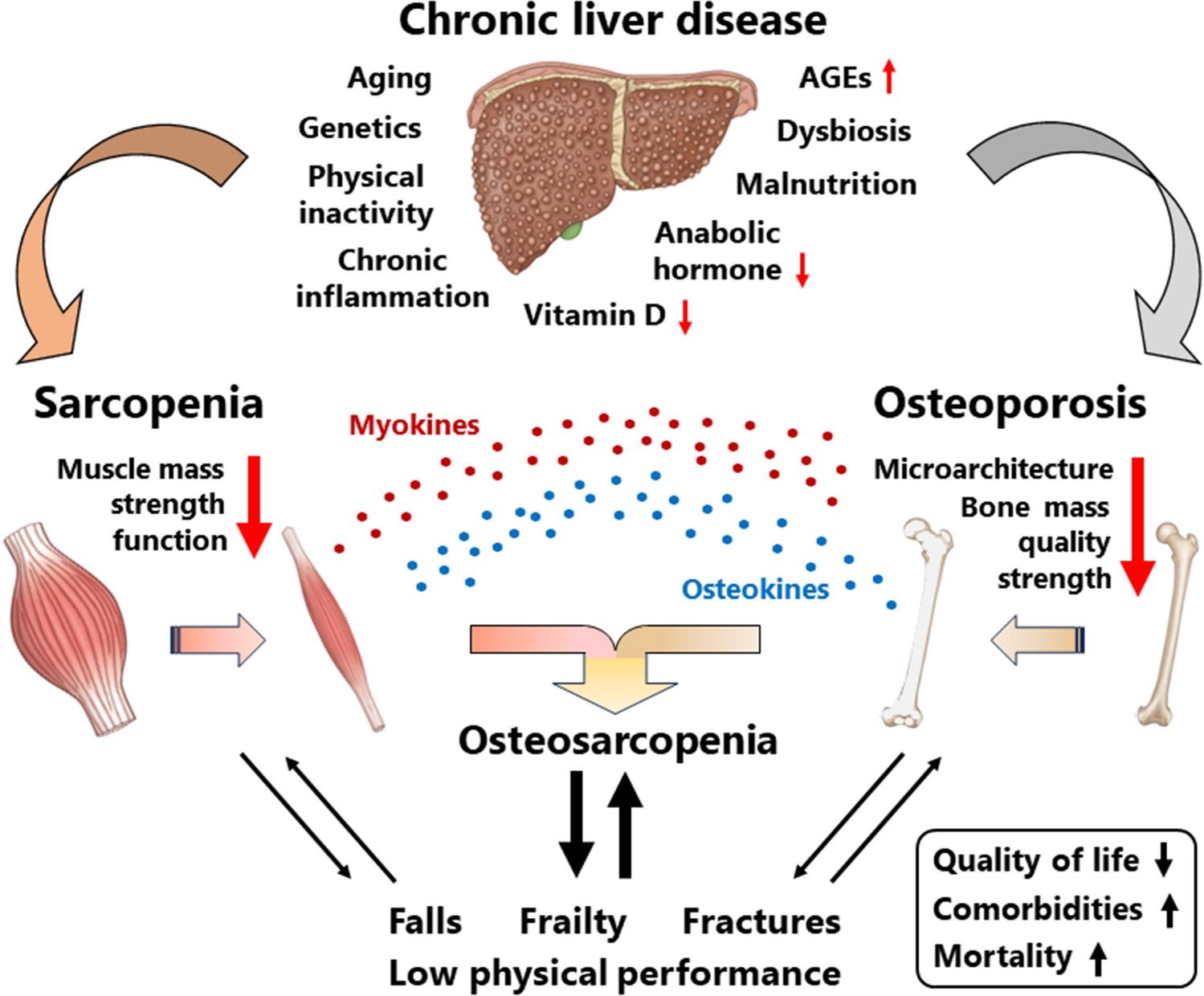 Association of chronic liver disease with bone diseases and muscle weakness
