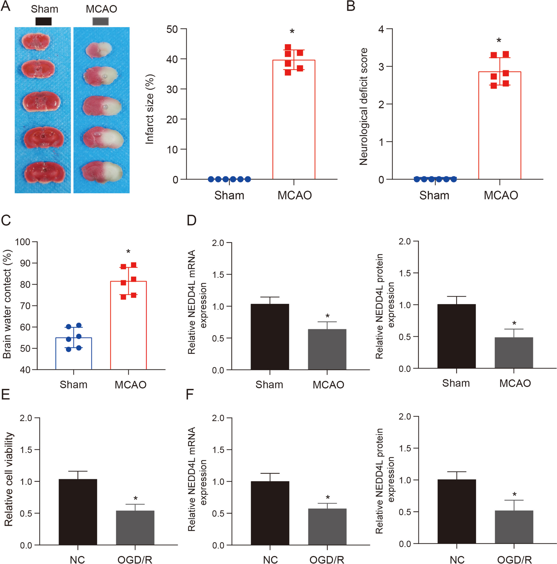 METTL3 regulates TFRC ubiquitination and ferroptosis through stabilizing NEDD4L mRNA to impact stroke