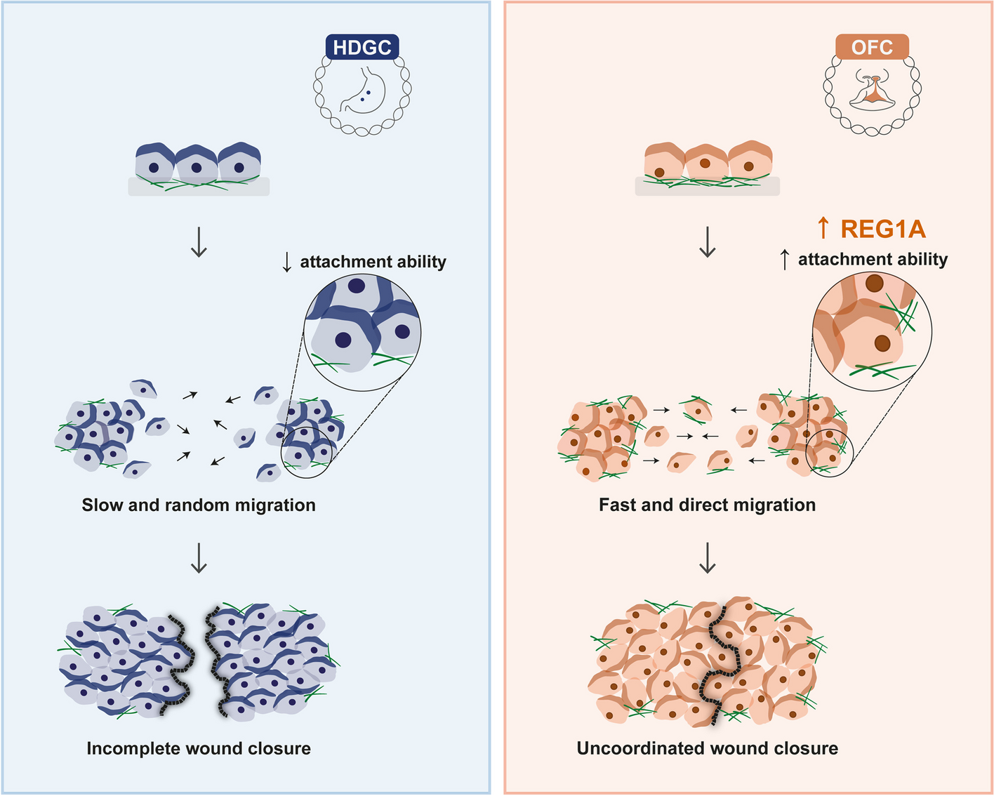 E-cadherin variants associated with oral facial clefts trigger aberrant cell motility in a REG1A-dependent manner