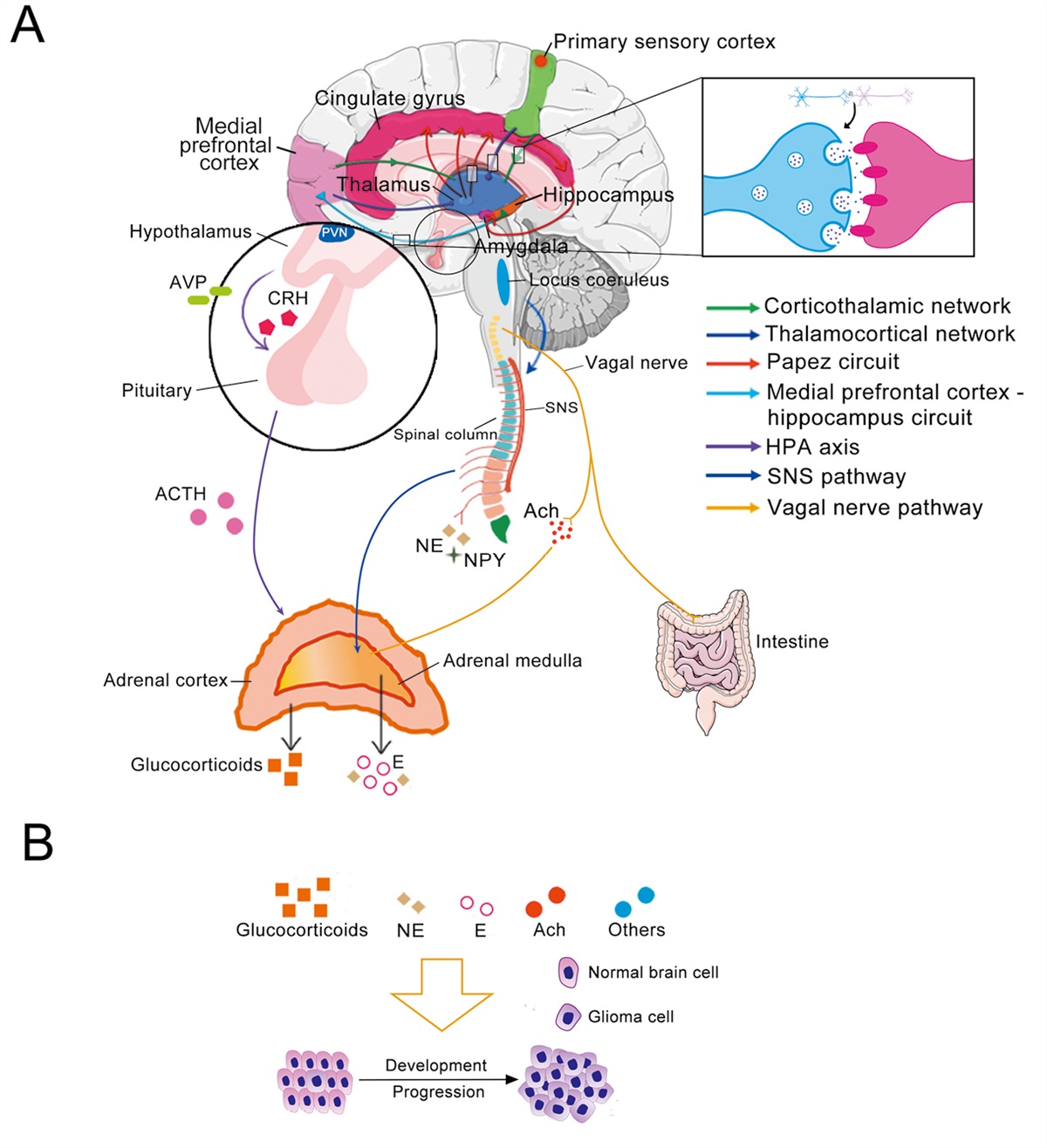 Chronic stress as an emerging risk factor for the development and progression of glioma