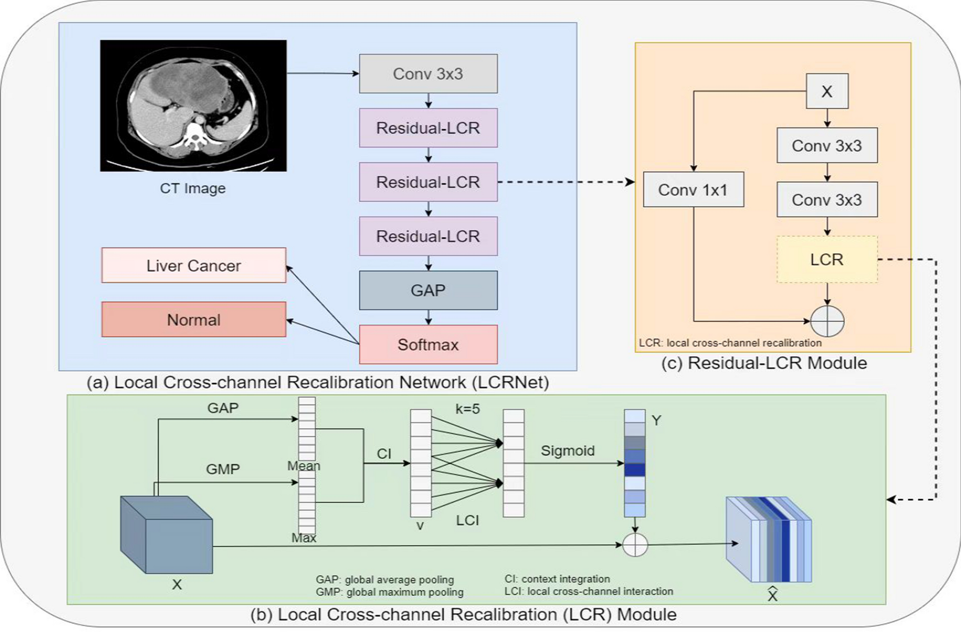LCRNet: local cross-channel recalibration network for liver cancer classification based on CT images