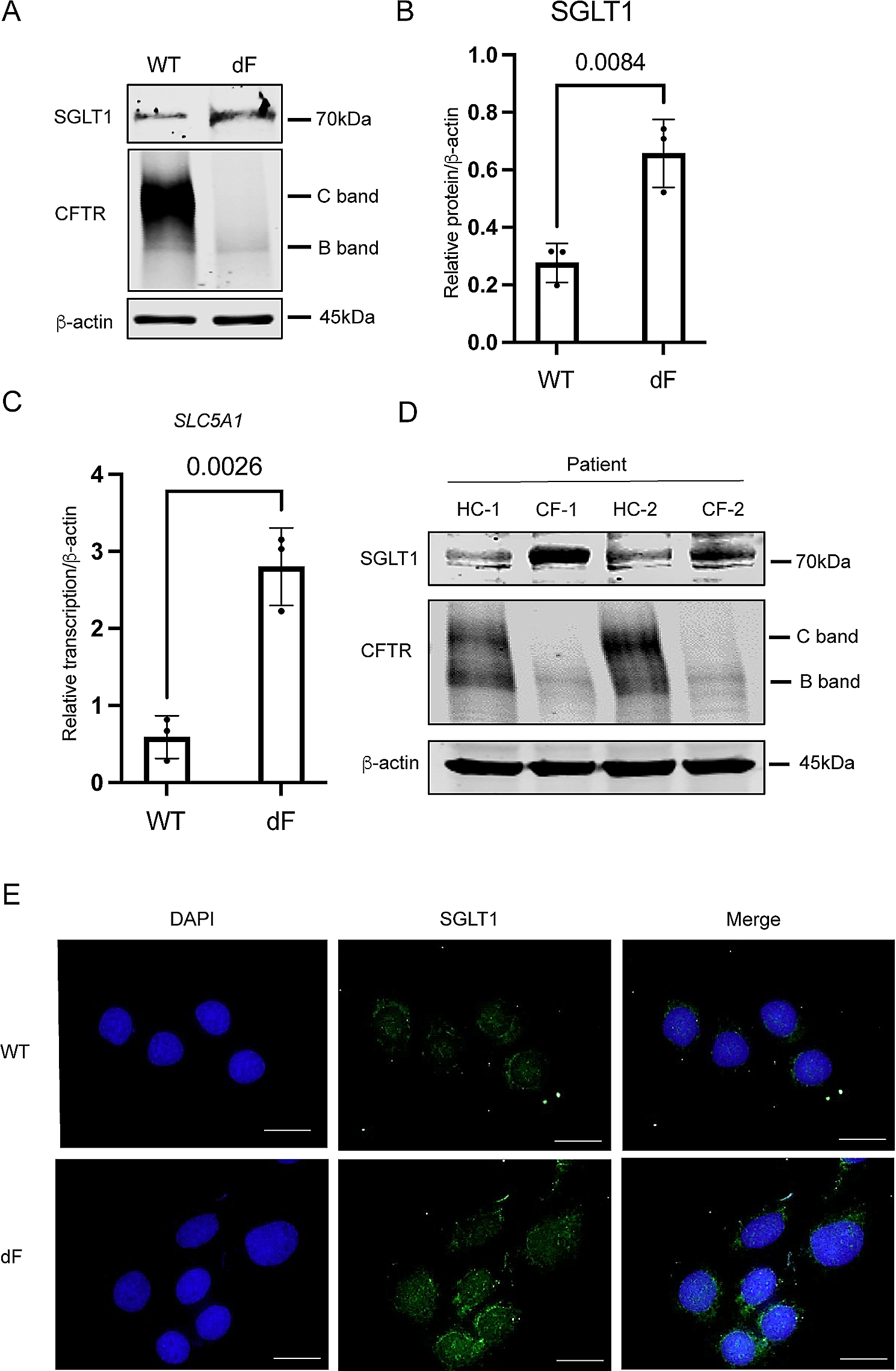 XBP1-mediated transcriptional regulation of SLC5A1 in human epithelial cells in disease conditions