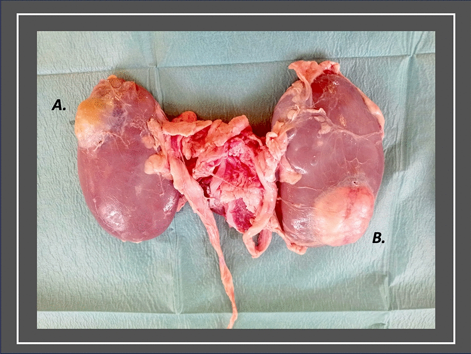 Design and utilisation of a novel, high-fidelity, low-cost, hybrid-tissue simulation model to facilitate training in robot-assisted partial nephrectomy