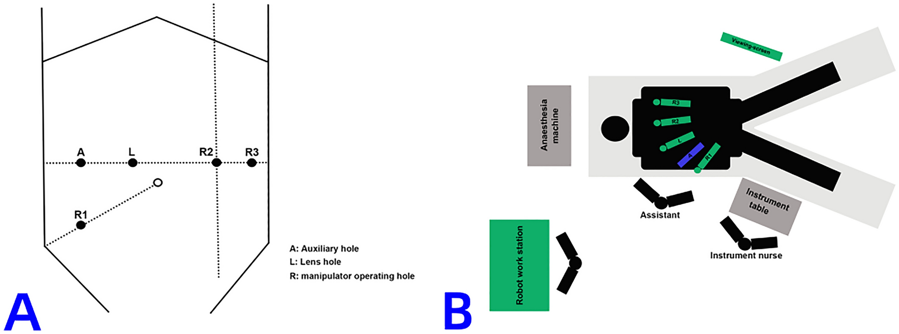 Sphincter-preserving effect of robotic-assisted intersphincteric resection for ultra-low rectal cancer: a propensity score matching analysis