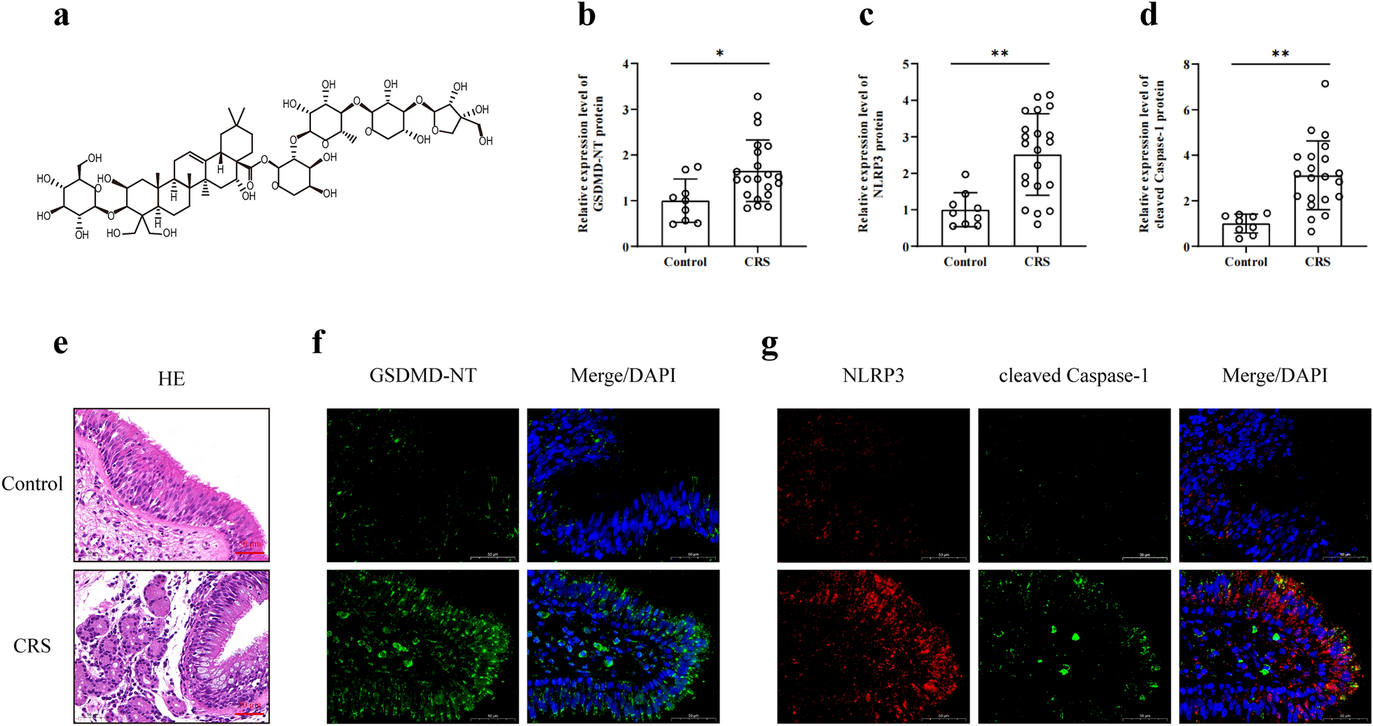 Platycodon D protects human nasal epithelial cells from pyroptosis through the Nrf2/HO-1/ROS signaling cascade in chronic rhinosinusitis