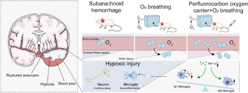 Novel perfluorocarbon-based oxygenation therapy alleviates Post-SAH hypoxic brain injury by inhibiting HIF-1α