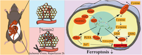 Sestrin2 reduces ferroptosis via the Keap1/Nrf2 signaling pathway after intestinal ischemia-reperfusion