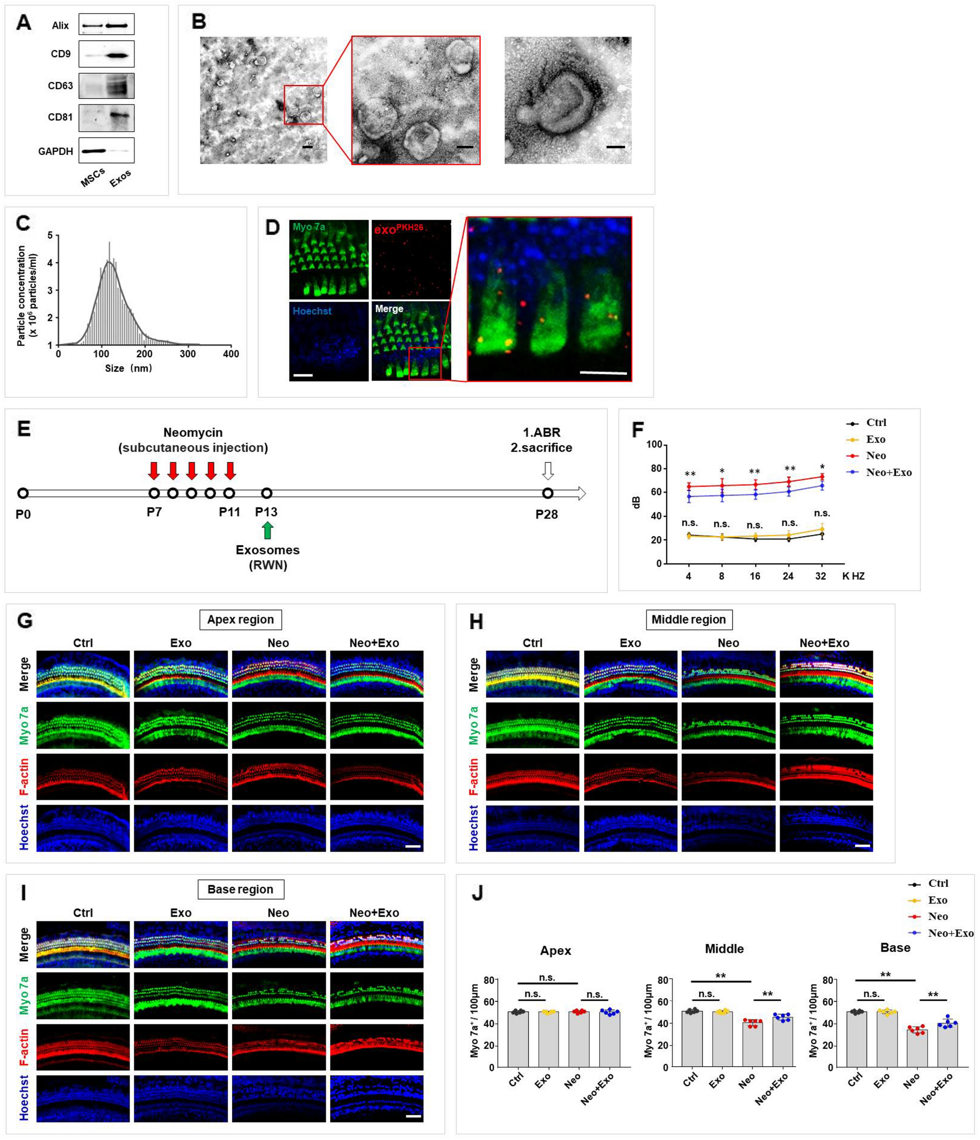 MSC-derived exosomes protect auditory hair cells from neomycin-induced damage via autophagy regulation