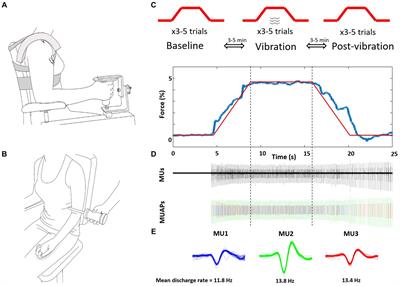 Short term effects of contralateral tendon vibration on motor unit discharge rate variability and force steadiness in people with Parkinson’s disease