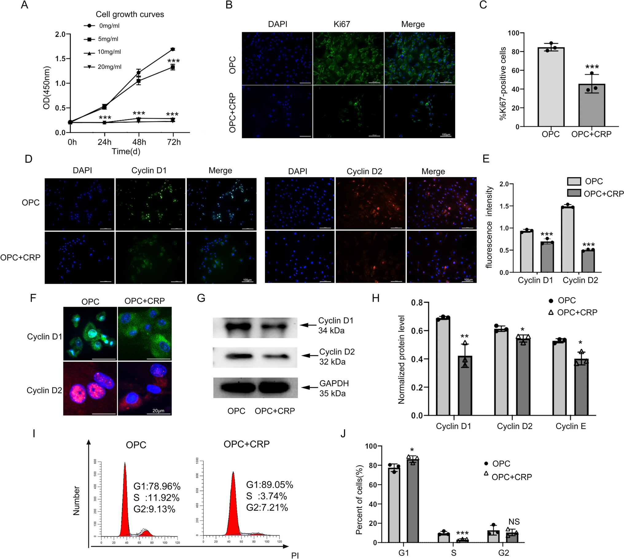 CRP inhibits the osteoblastic differentiation of OPCs via the up-regulation of primary cilia and repression of the Hedgehog signaling pathway