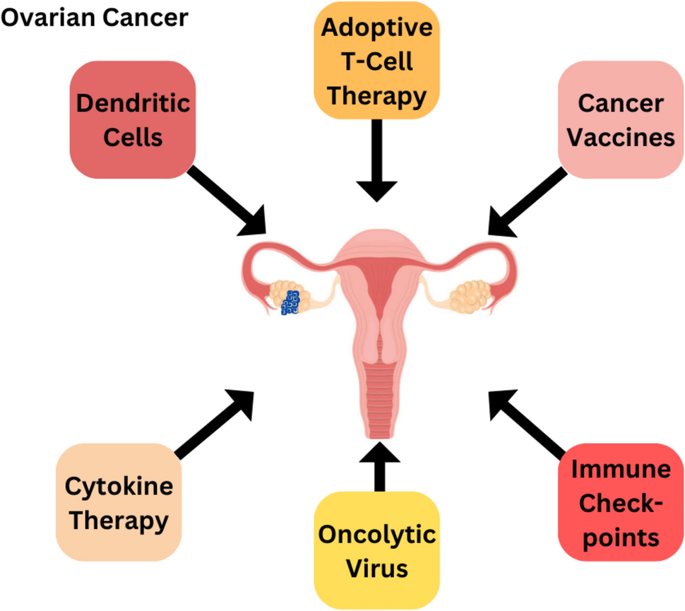 Unlocking the ‘ova’-coming power: immunotherapy’s role in shaping the future of ovarian cancer treatment