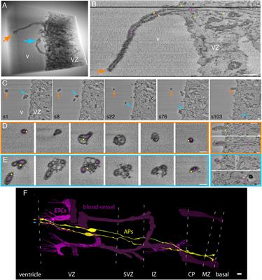 High-resolution 3D ultrastructural analysis of developing mouse neocortex reveals long slender processes of endothelial cells that enter neural cells