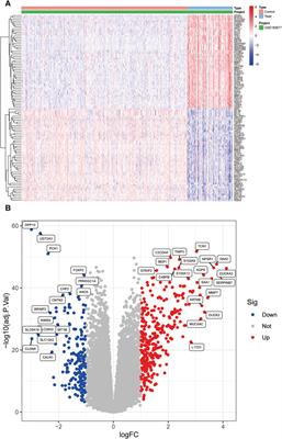 Elucidating the role of TWIST1 in ulcerative colitis: a comprehensive bioinformatics and machine learning approach