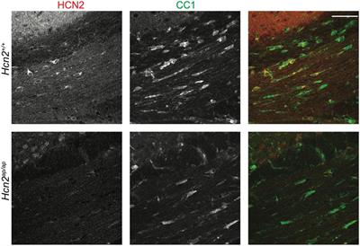 Characterization of hyperpolarization-activated cyclic nucleotide-gated channels in oligodendrocytes