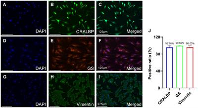 Comparison of the effects of EGF, FGF-b, and NGF on the proliferation, migration, and reprogramming of primary rat Müller cells
