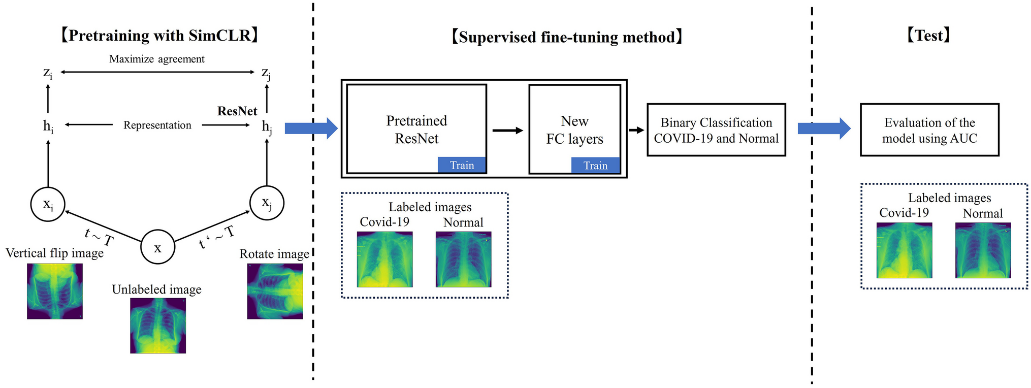 Evaluation of Effectiveness of Self-Supervised Learning in Chest X-Ray Imaging to Reduce Annotated Images