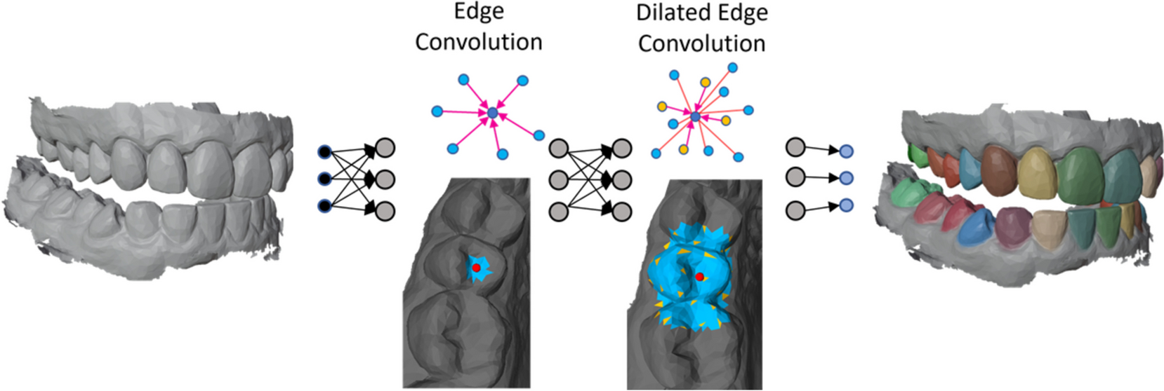 DilatedToothSegNet: Tooth Segmentation Network on 3D Dental Meshes Through Increasing Receptive Vision