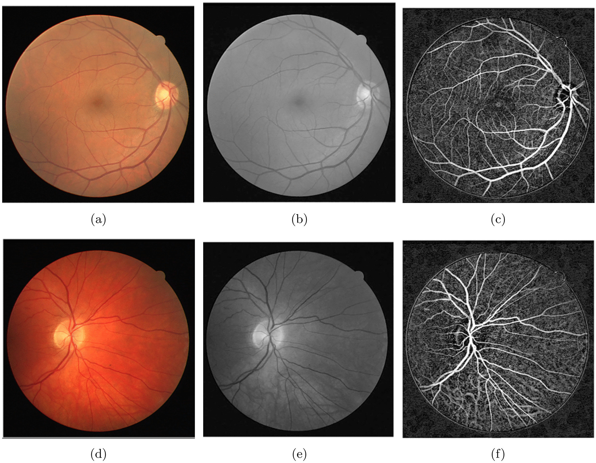 Systematic Review of Retinal Blood Vessels Segmentation Based on AI-driven Technique