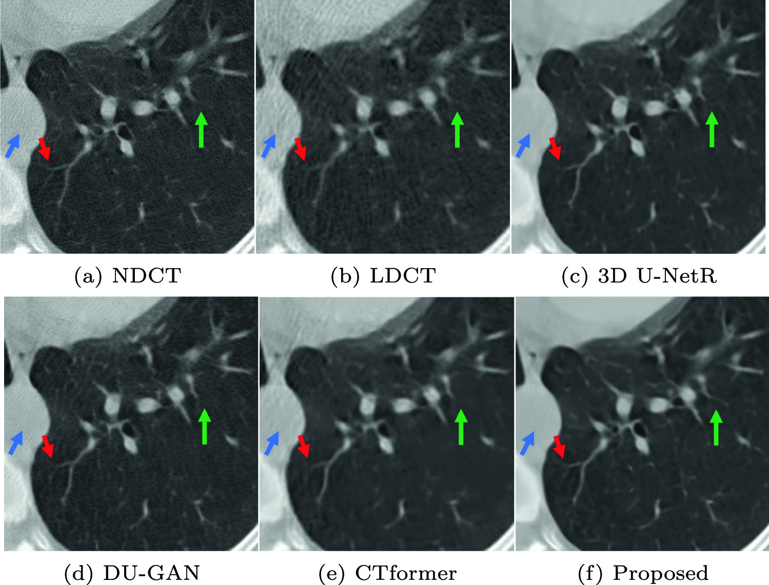 A Hybrid Framework of Dual-Domain Signal Restoration and Multi-depth Feature Reinforcement for Low-Dose Lung CT Denoising