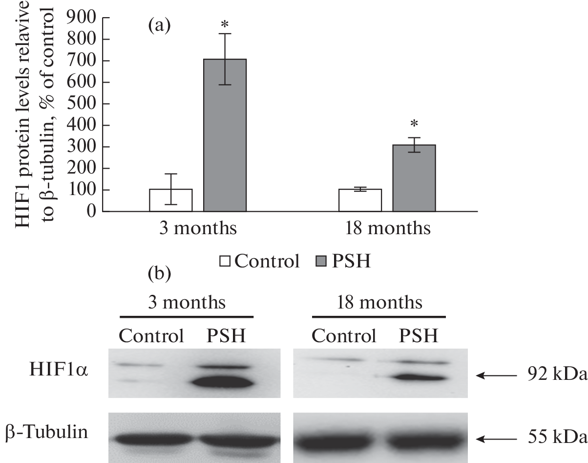 Prenatal Hypoxia Causes an Increase in the Content and Transcriptional Activity of the Hypoxia-Inducible Factor HIF1α in the Hippocampus of Adult and Aging Rats