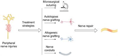 Advancements in autologous peripheral nerve transplantation care: a review of strategies and practices to facilitate recovery