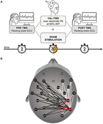 Coherent activity within and between hemispheres: cortico-cortical connectivity revealed by rTMS of the right posterior parietal cortex