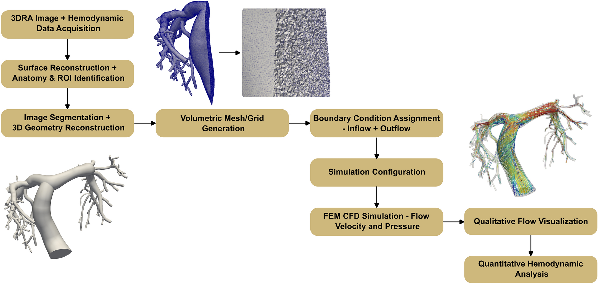 Computational Fluid Dynamic Assessment of Patients with Congenital Heart Disease from 3D Rotational Angiography