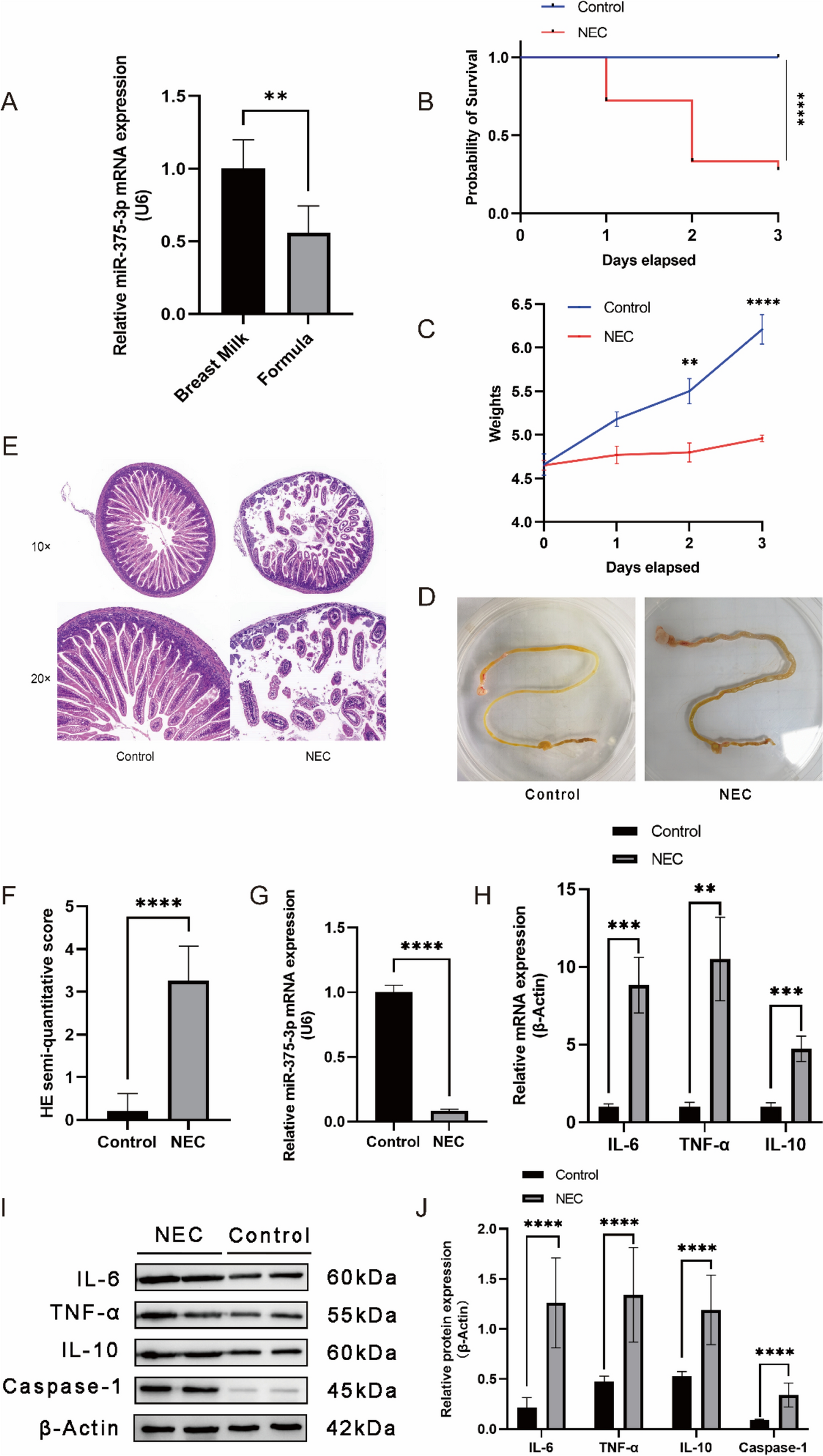 miR-375-3p targets YWHAB to attenuate intestine injury in neonatal necrotizing enterocolitis
