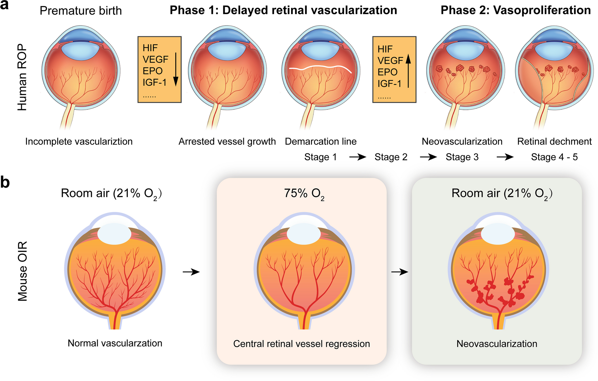 Targeting adenosine A2A receptors for early intervention of retinopathy of prematurity