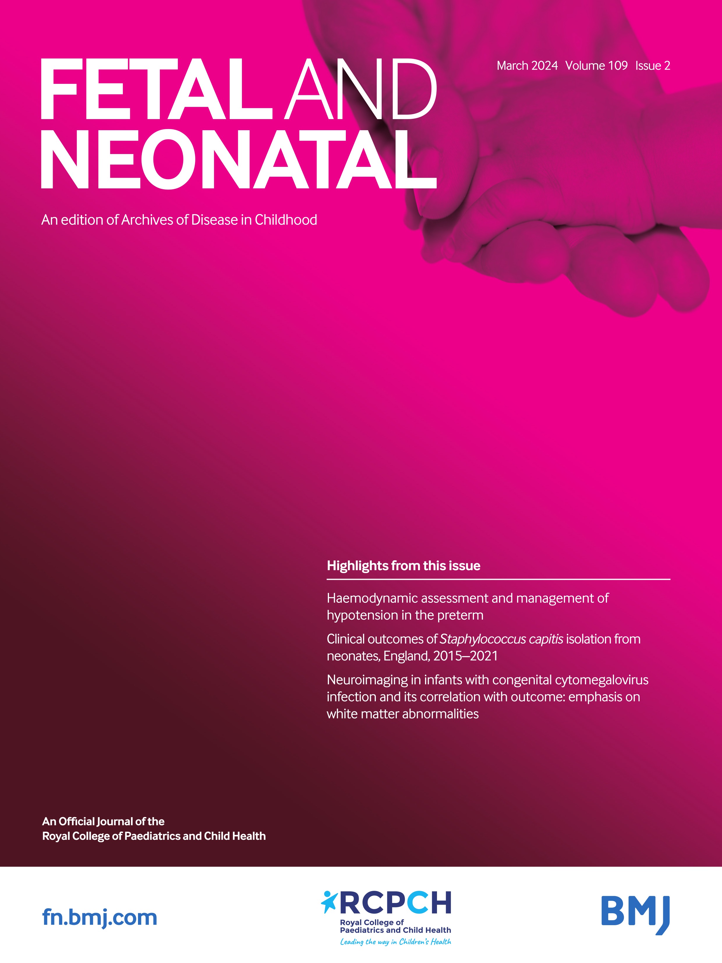 Impact of adopting a neonatal sepsis risk calculator in a diverse population in Birmingham, UK