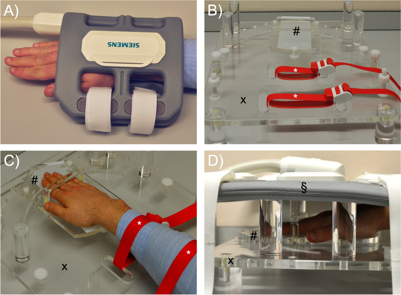 Dynamic assessment of scapholunate ligament status by real-time magnetic resonance imaging: an exploratory clinical study
