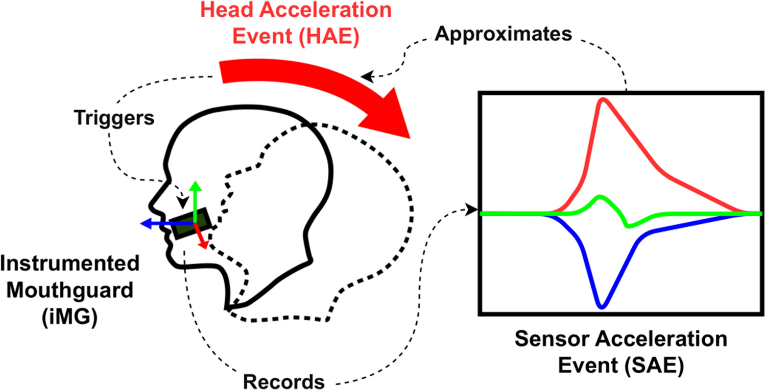 When to Pull the Trigger: Conceptual Considerations for Approximating Head Acceleration Events Using Instrumented Mouthguards