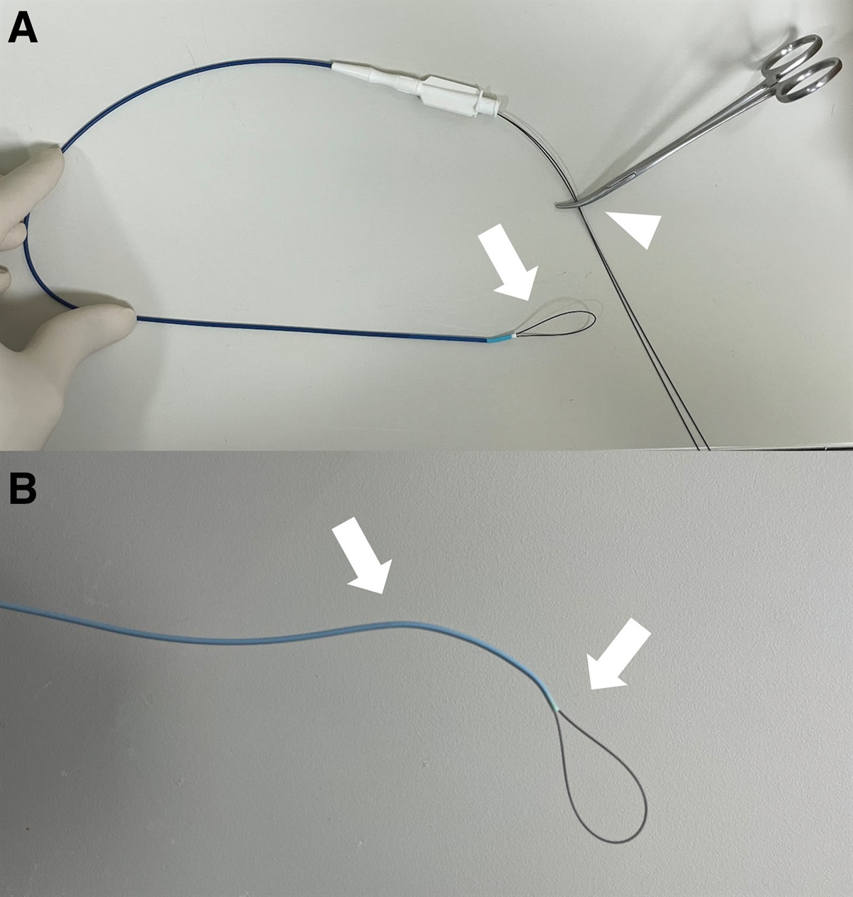 Technical feasibility and safety of the alternative snare technique using a 0.018-inch guide wire and 5-French catheter for double-J ureteral stent removal