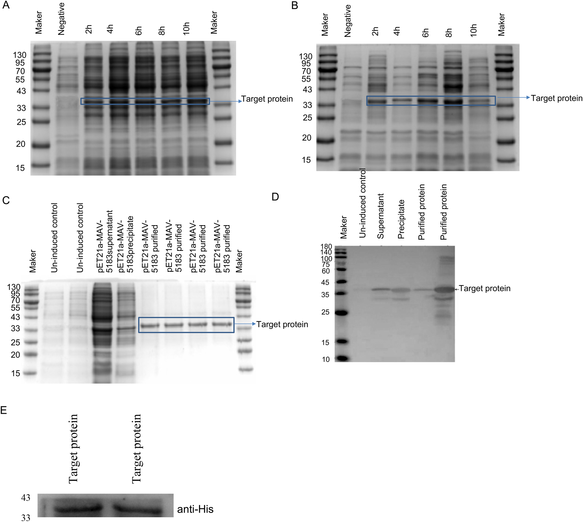 Effect and Mechanism of Mycobacterium avium MAV-5183 on Apoptosis of Mouse Ana-1 Macrophages