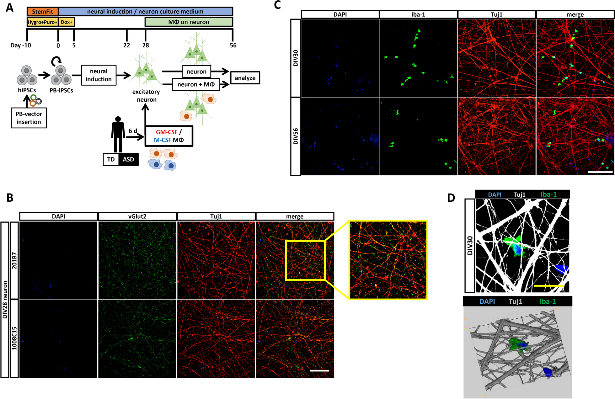 Granulocyte macrophage colony-stimulating factor-induced macrophages of individuals with autism spectrum disorder adversely affect neuronal dendrites through the secretion of pro-inflammatory cytokines