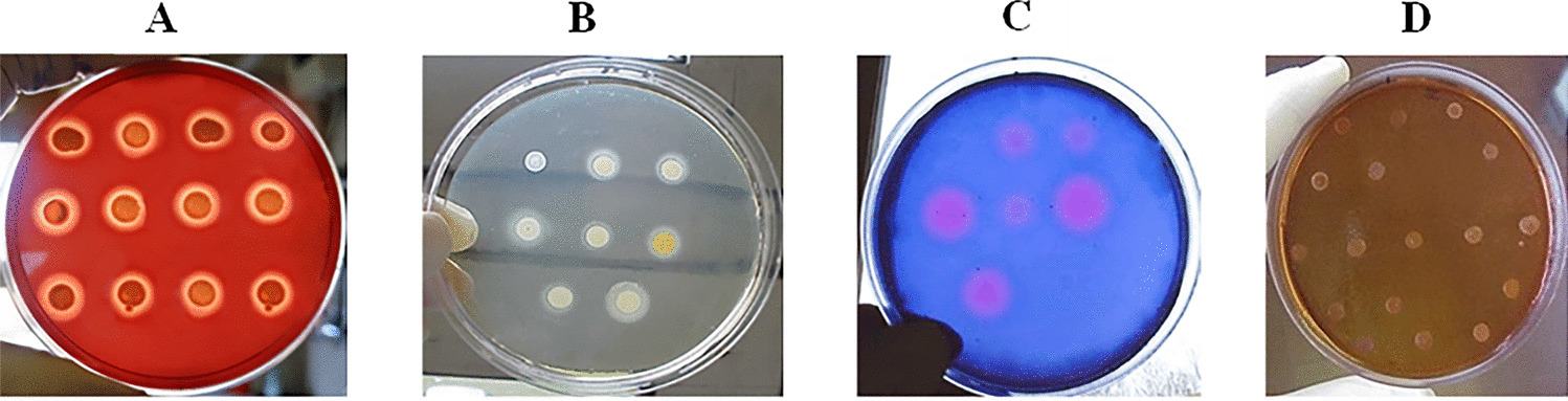 Characterization of virulence factors and antimicrobial resistance in Staphylococcus spp. isolated from clinical samples
