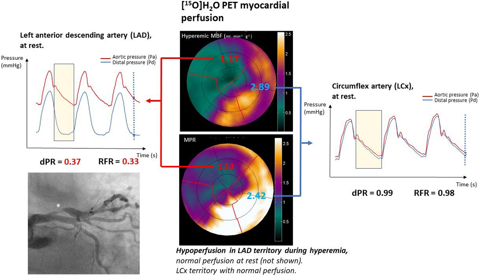 Validation of resting full-cycle ratio and diastolic pressure ratio with [15O]H2O positron emission tomography myocardial perfusion