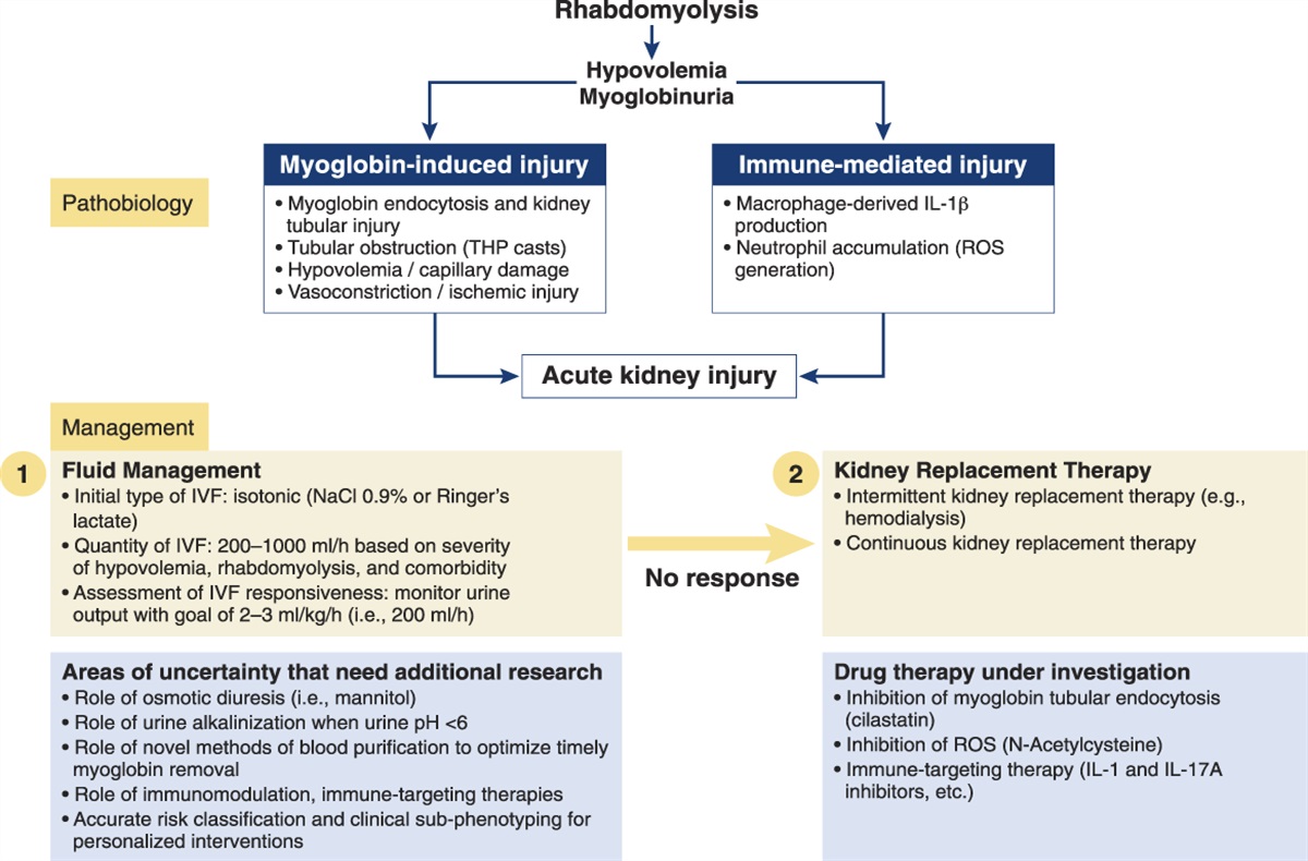 How I Treat Rhabdomyolysis-Induced AKI?