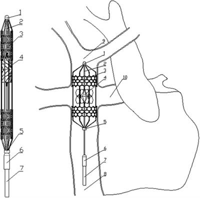 Study on the optimal elastic modulus of flexible blades for right heart assist device supporting patients with single-ventricle physiologies