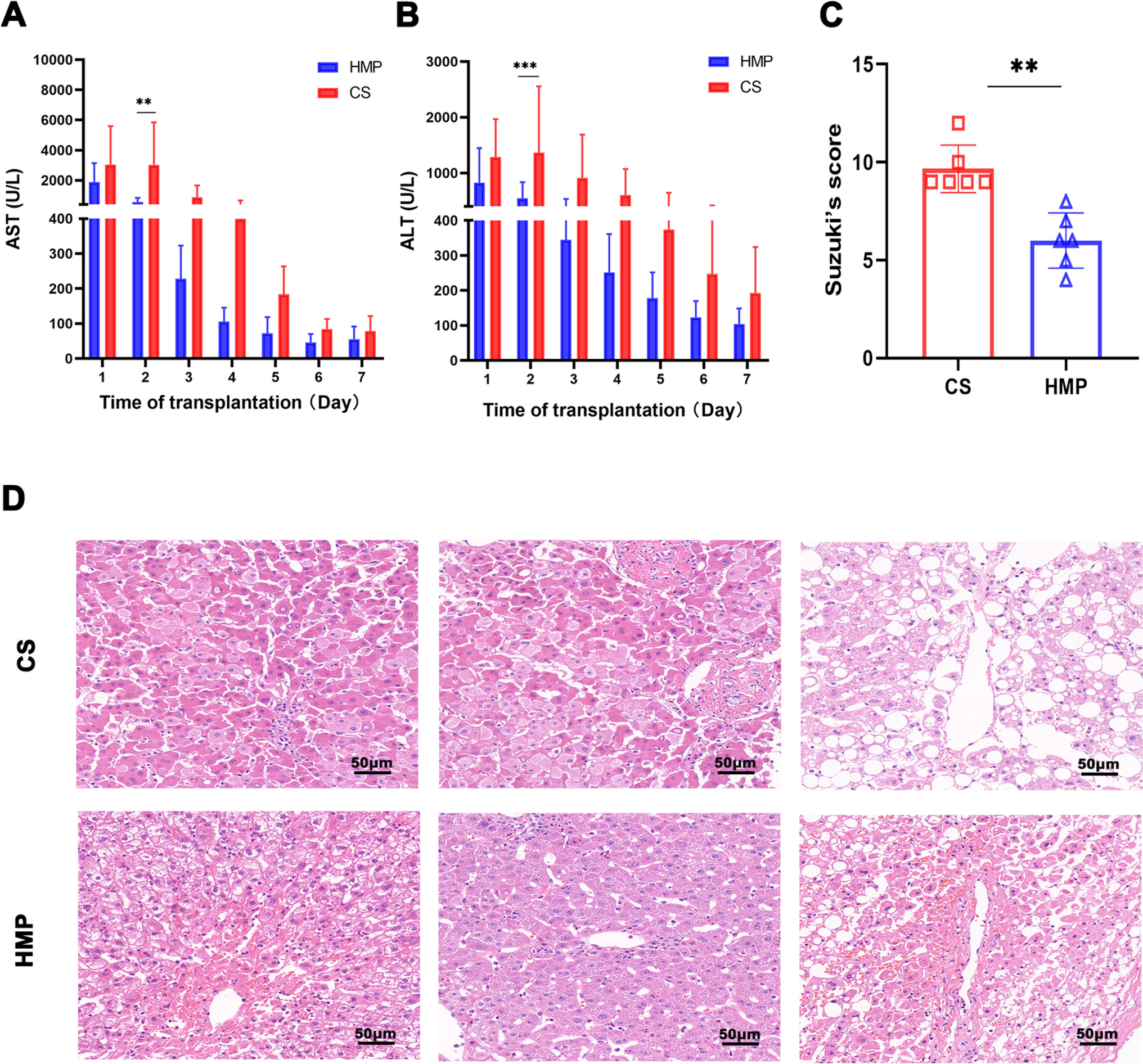 Hypothermic machine perfusion reduces donation after circulatory death liver ischemia–reperfusion injury through the SERPINA3-mediated PI3Kδ/Akt pathway