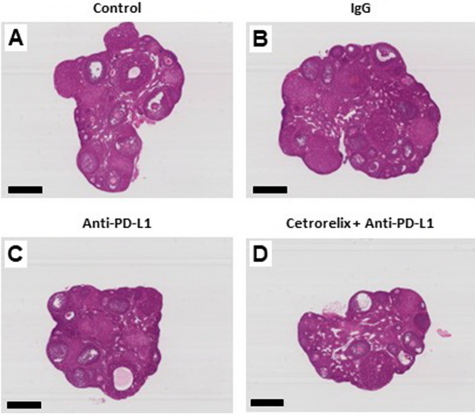 Effects of Cetrorelix on Ovary and Endometrium Prior to Anti-PD-L1 Antibody in Murine Model