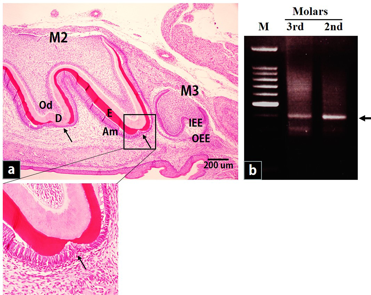 Regulatory role of N-myc downregulated genes in amelogenesis in rats