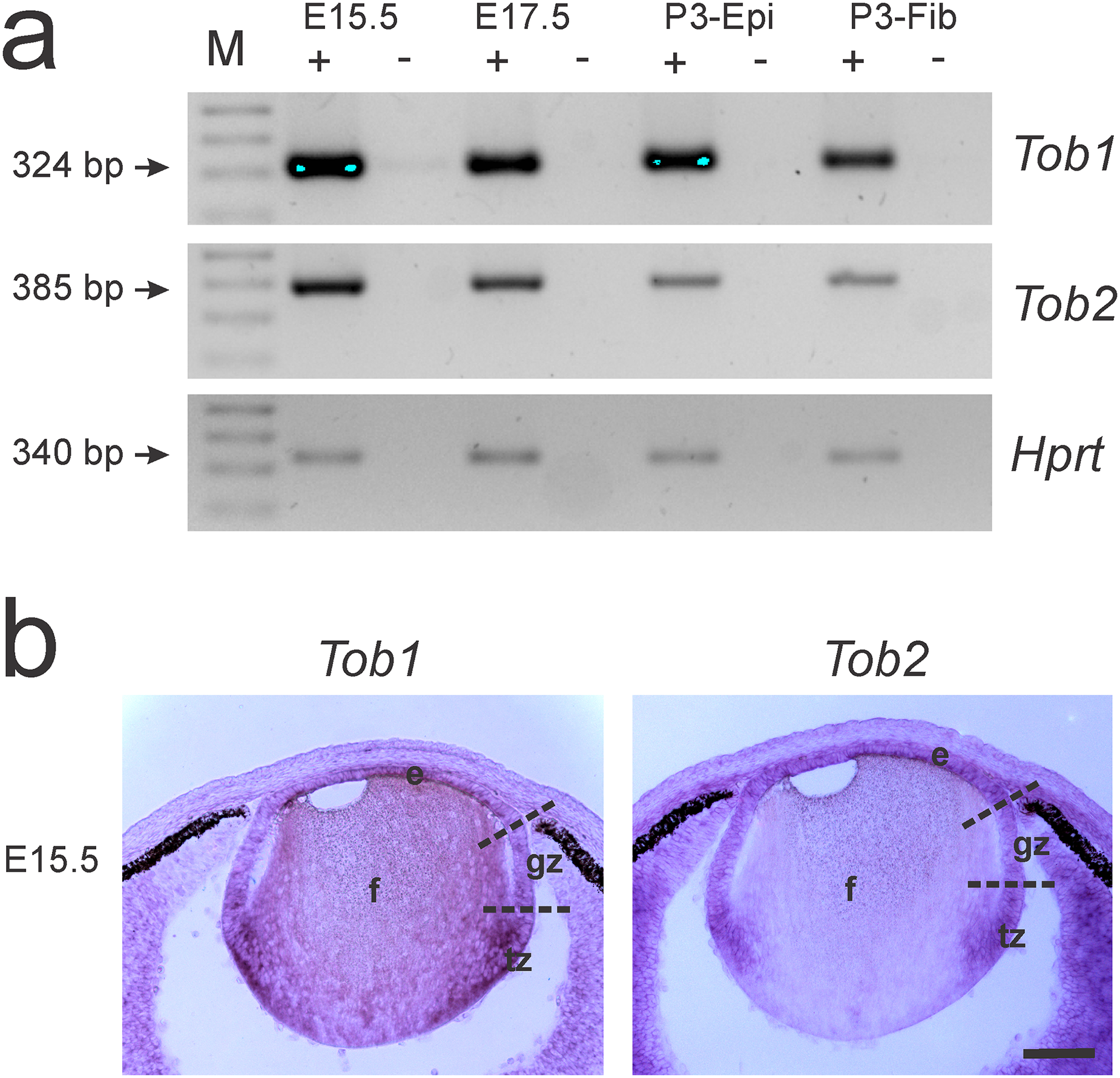 TOB1 and TOB2 mark distinct RNA processing granules in differentiating lens fiber cells