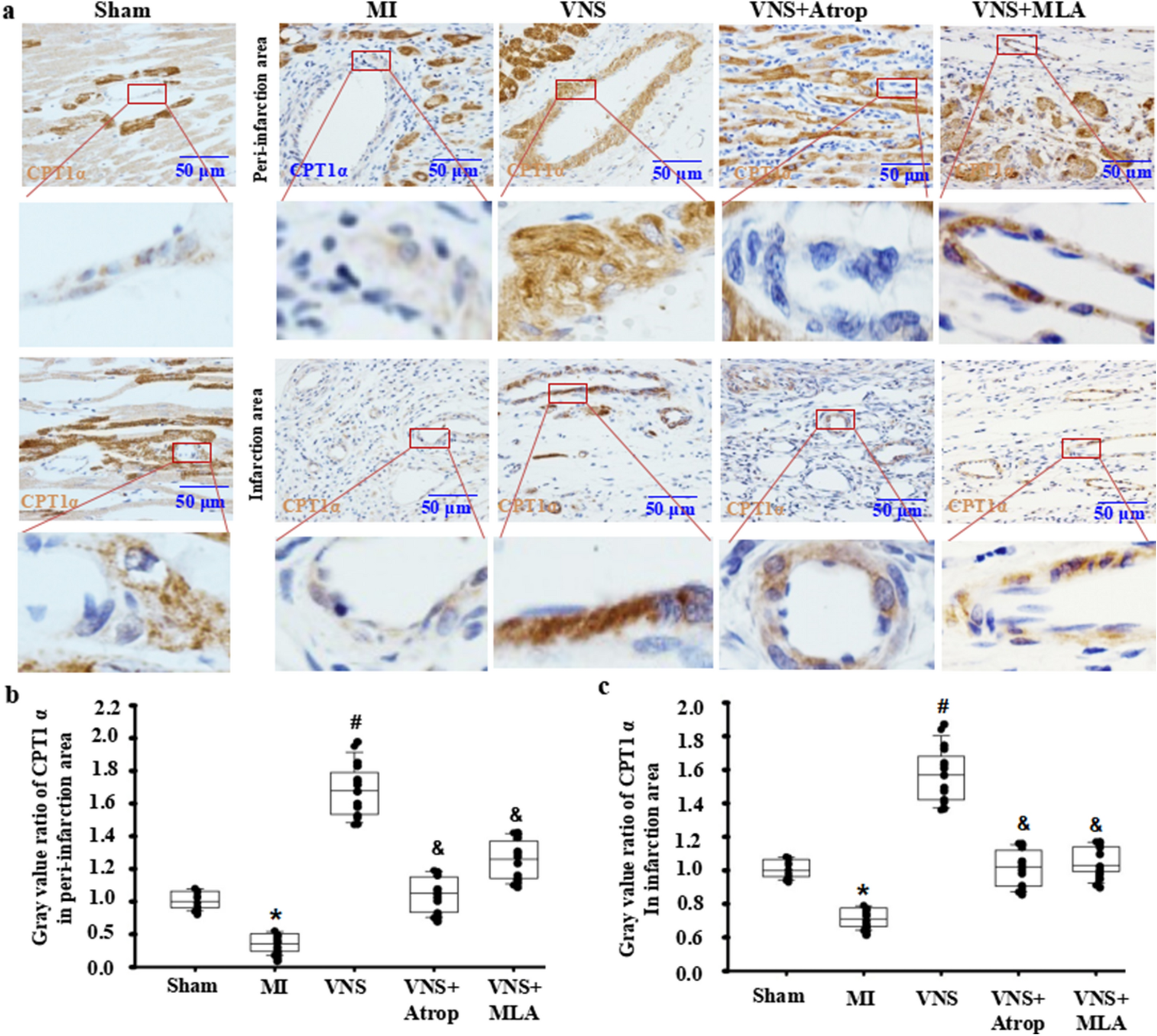 VNS improves VSMC metabolism and arteriogenesis in infarcted hearts through m/n-AChR-Akt-SDF-1α in adult male rats