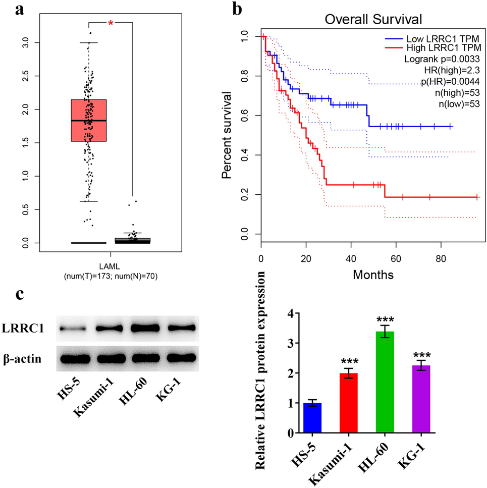 LRRC1 knockdown downregulates MACF1 to inhibit the malignant progression of acute myeloid leukemia by inactivating β-catenin/c-Myc signaling