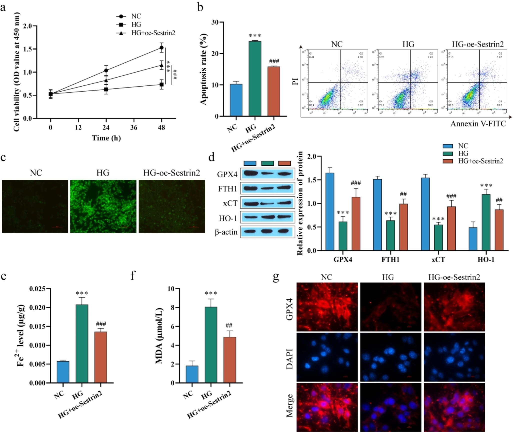 Sestrin2 ameliorates diabetic retinopathy by regulating autophagy and ferroptosis