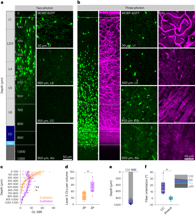 Long-term in vivo three-photon imaging reveals region-specific differences in healthy and regenerative oligodendrogenesis