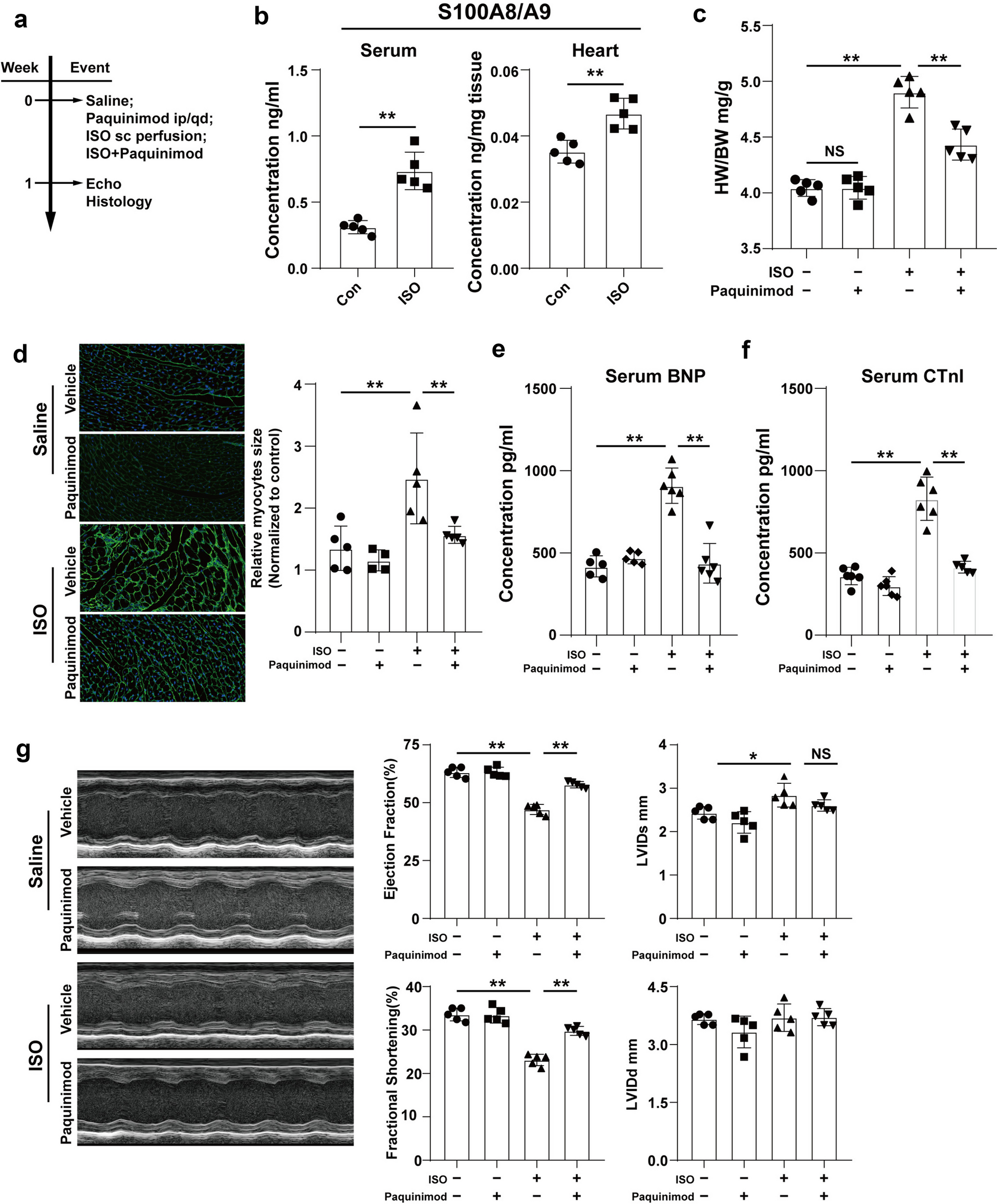 Targeting S100A9 Prevents β-Adrenergic Activation–Induced Cardiac Injury