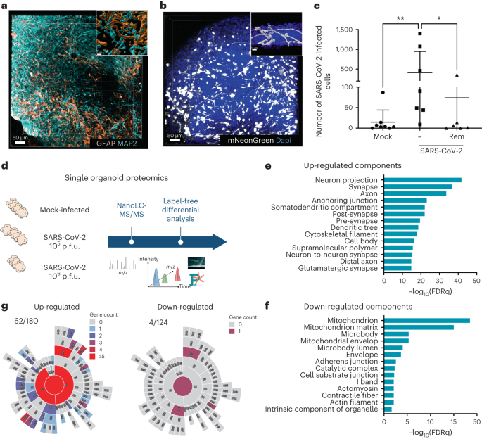 Brain exposure to SARS-CoV-2 virions perturbs synaptic homeostasis